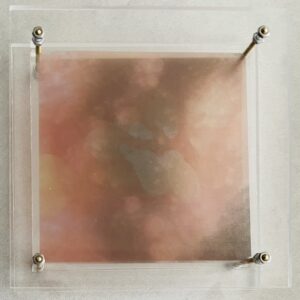 Ro-Nalt Schrauwen - Lichaamseigen I